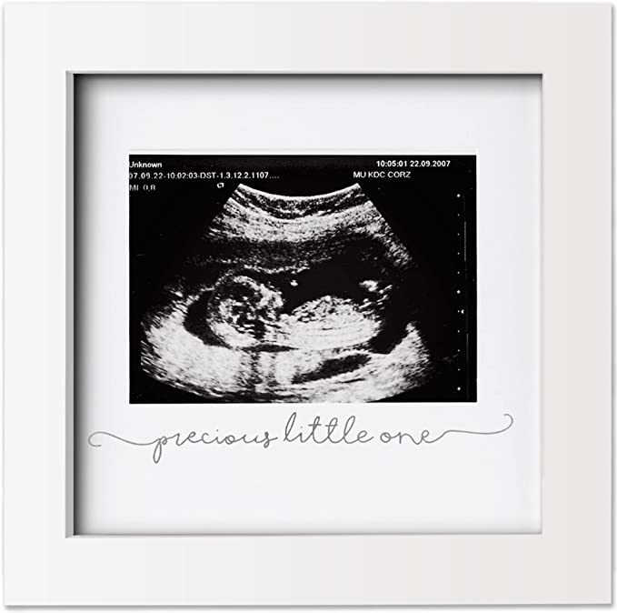 KeaBabies Store Baby Sonogram Picture Frame.