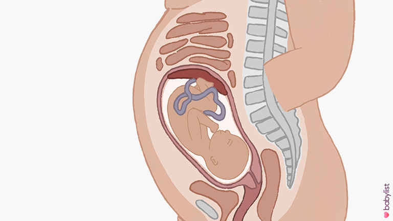 Pregnancy-Ultrasound-week-29