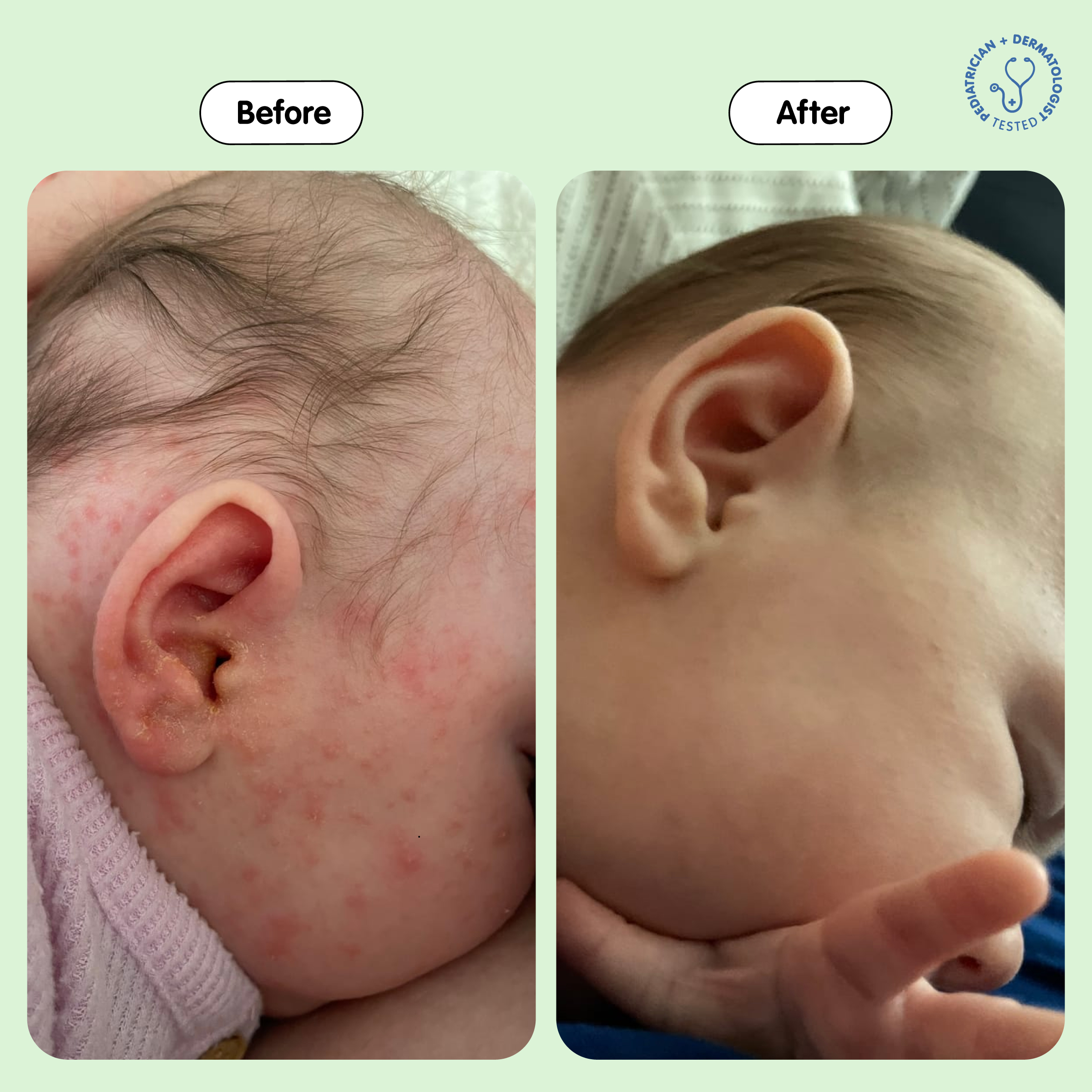 Tubby Todd All Over Ointment - Fragrance-Free, 8 Oz, 2.