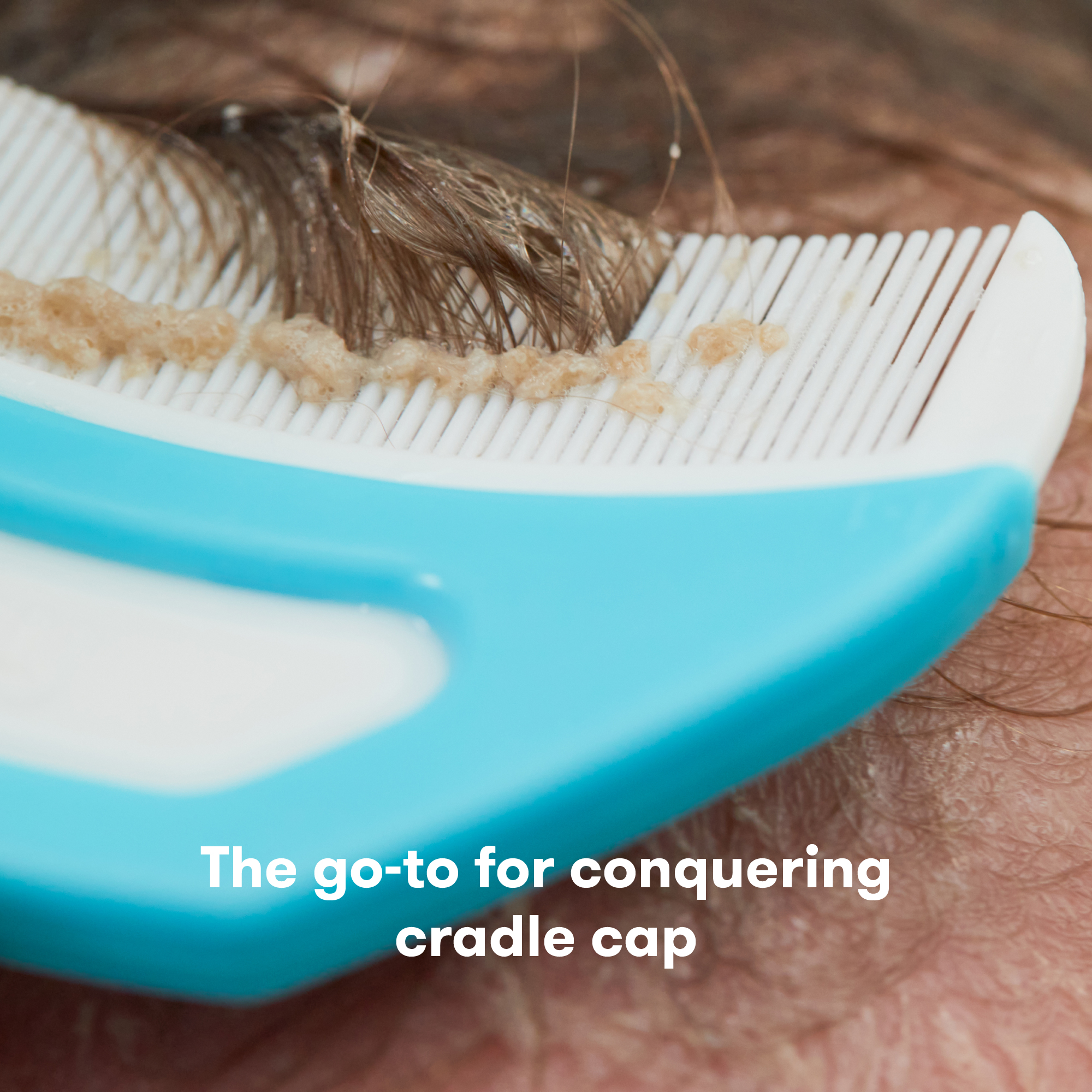 Frida Baby DermaFrida The FlakeFixer The 3-Step Cradle Cap System.