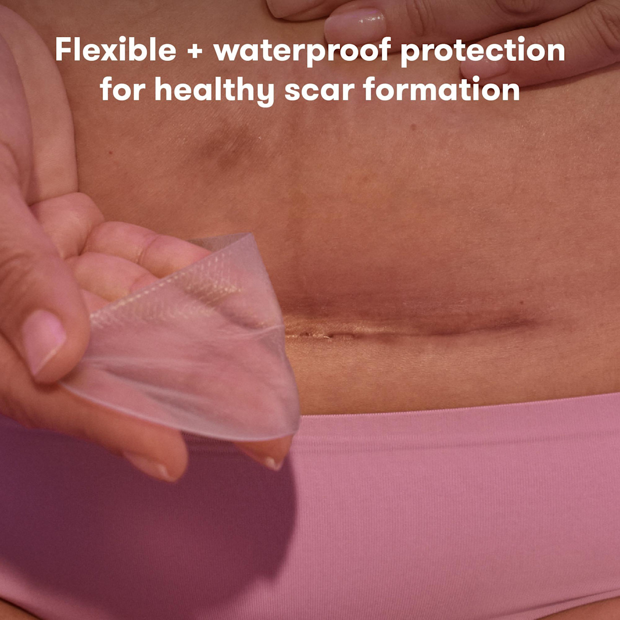 Frida Mom Silicone Scar Patches - 6.