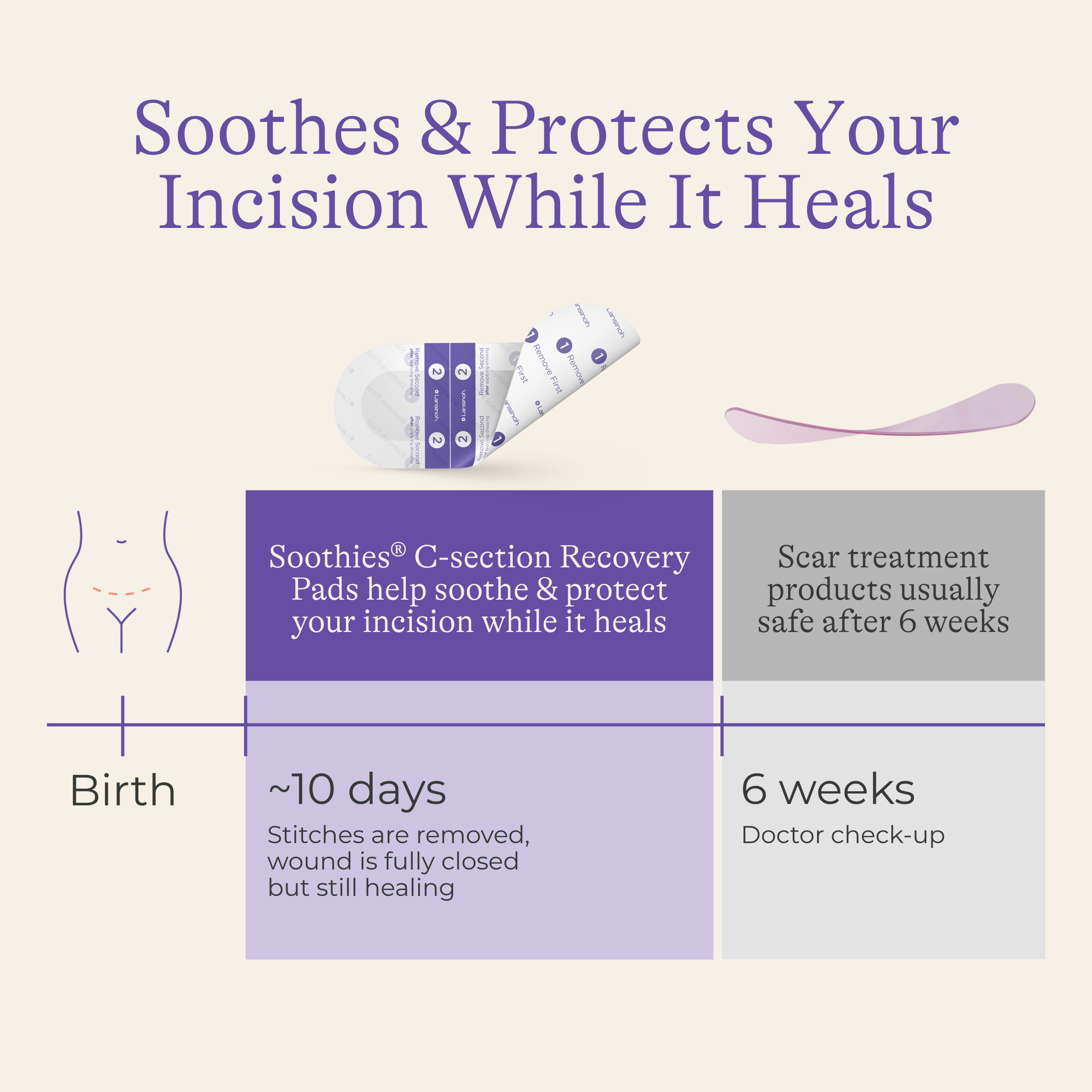 Lansinoh Soothies C-section Recovery Pads.
