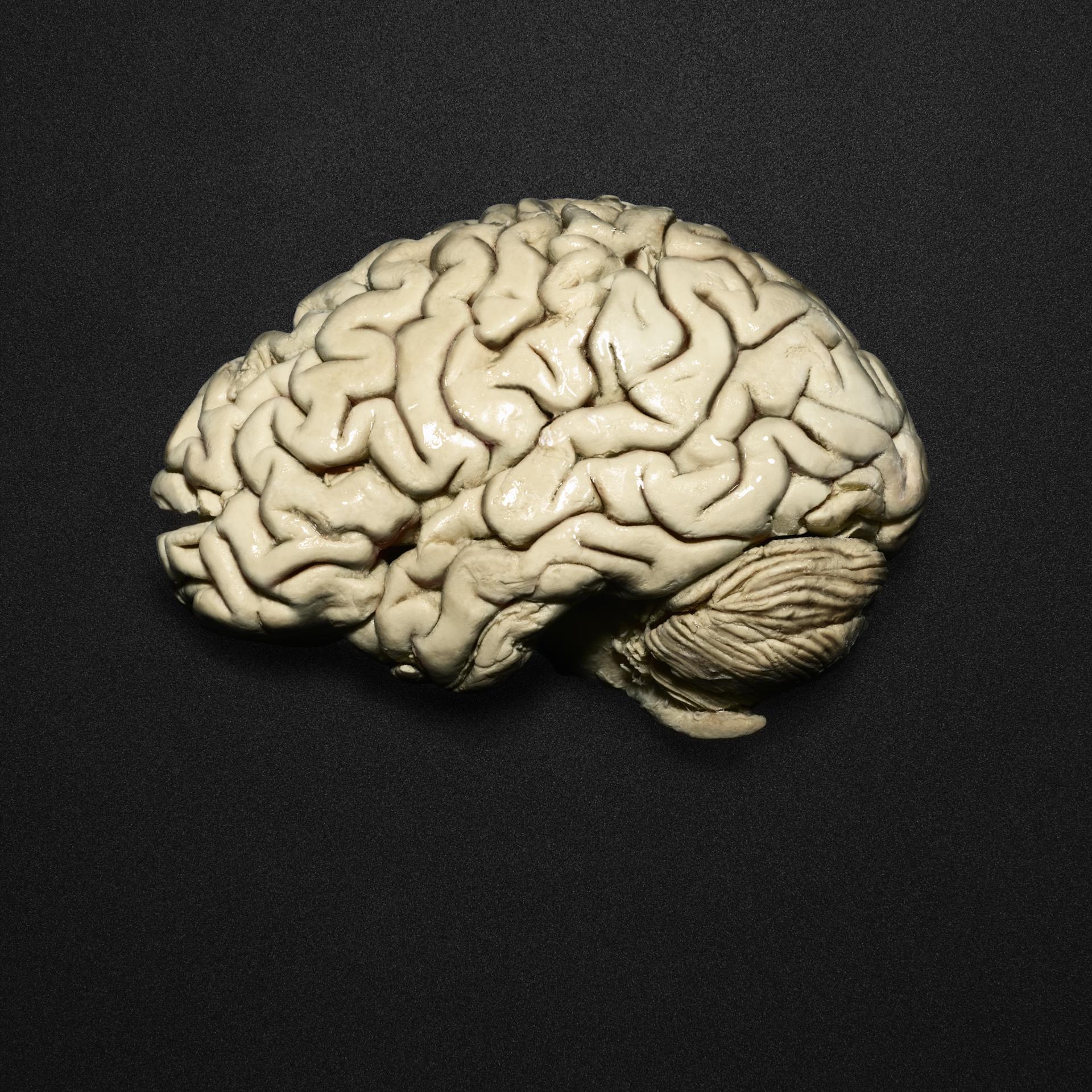 Brain 8 1. Мозг подростка. Старина миы. Сущность миы.