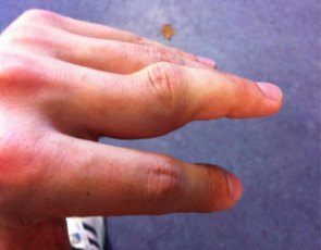 Warburton laughs off finger injury