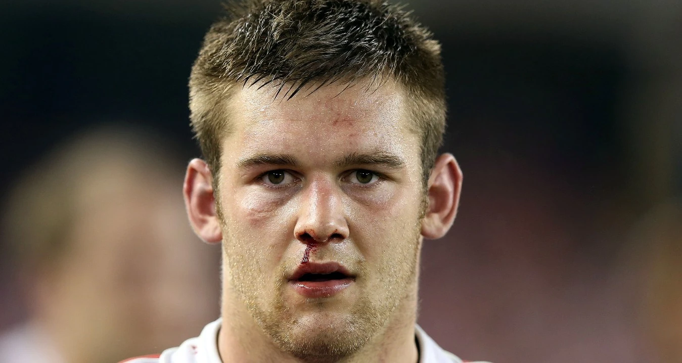 Lydiate is ready for battle
