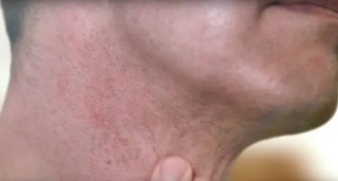 Prevenção da Irritação: Design de Lâminas Finas para Barbear