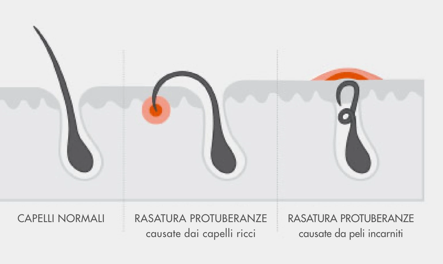 Come Trattare i Peli Incarniti e gli Sfoghi 