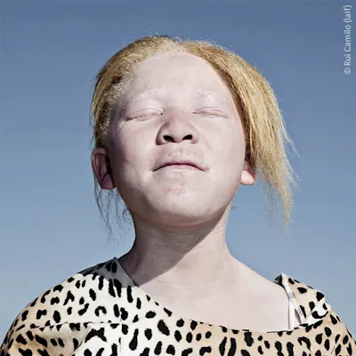 Portrait of a young person under a clear blue sky. The subject wears a leopard print top and has their eyes closed, facing the sun with a serene and confident expression. Artistic photograph with strong light-shadow contrast and powerful social commentary.
