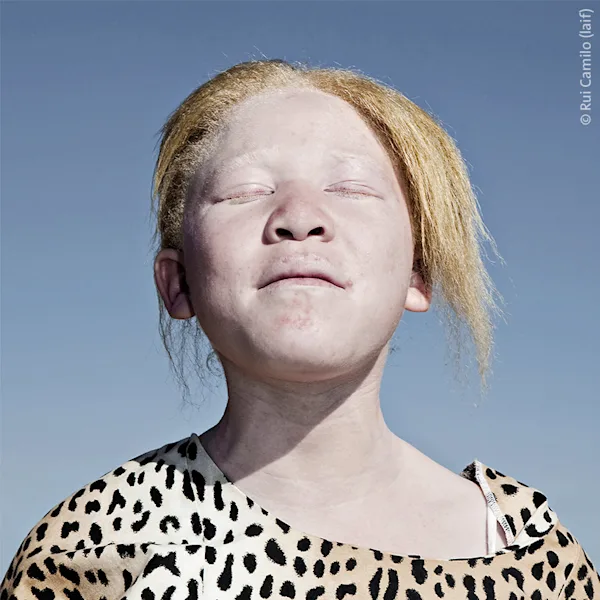 Portrait of a young person under a clear blue sky. The subject wears a leopard print top and has their eyes closed, facing the sun with a serene and confident expression. Artistic photograph with strong light-shadow contrast and powerful social commentary.