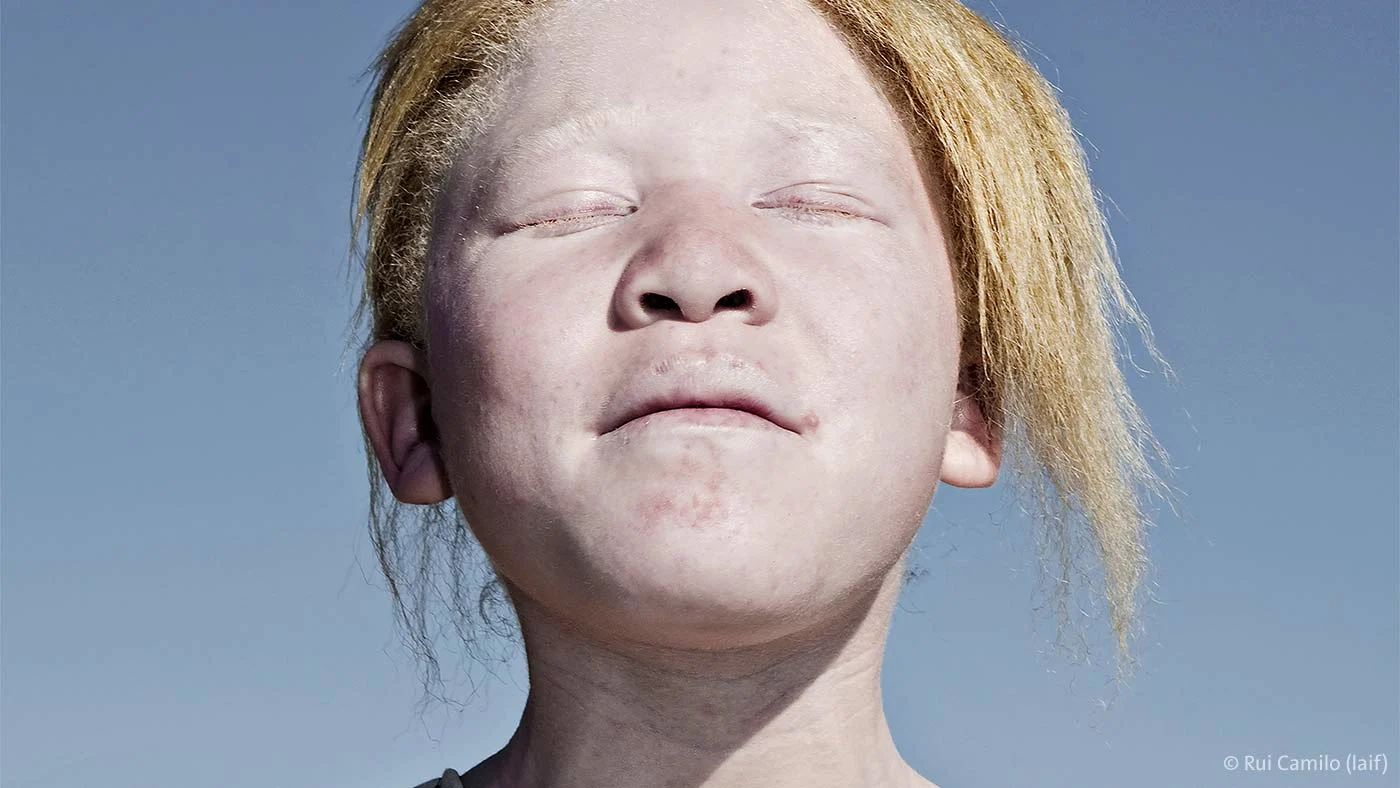 Portrait of a young person under a clear blue sky. The subject wears a leopard print top and has their eyes closed, facing the sun with a serene and confident expression. Artistic photograph with strong light-shadow contrast and powerful social commentary.