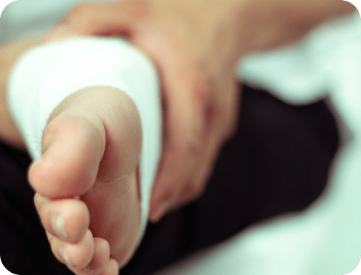 Close-up of a person's foot wrapped in gauze, ilustrating the comfort and security of HURT-FREE wraps.