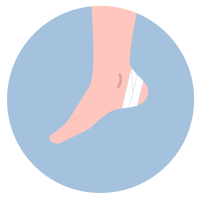 Illustration of a foot with a bandage wrapped around the heel, demonstrating proper care for a blister.