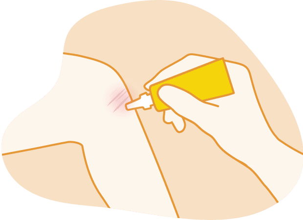 Illustration of a hand applying antibiotic ointment from a yellow tube to a minor cut on an arm to prevent infection.