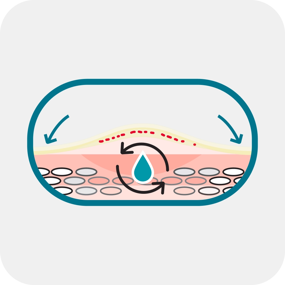 Advanced hydrocolloid technology which creates a moist environment