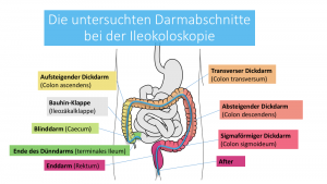 darmspiegelung