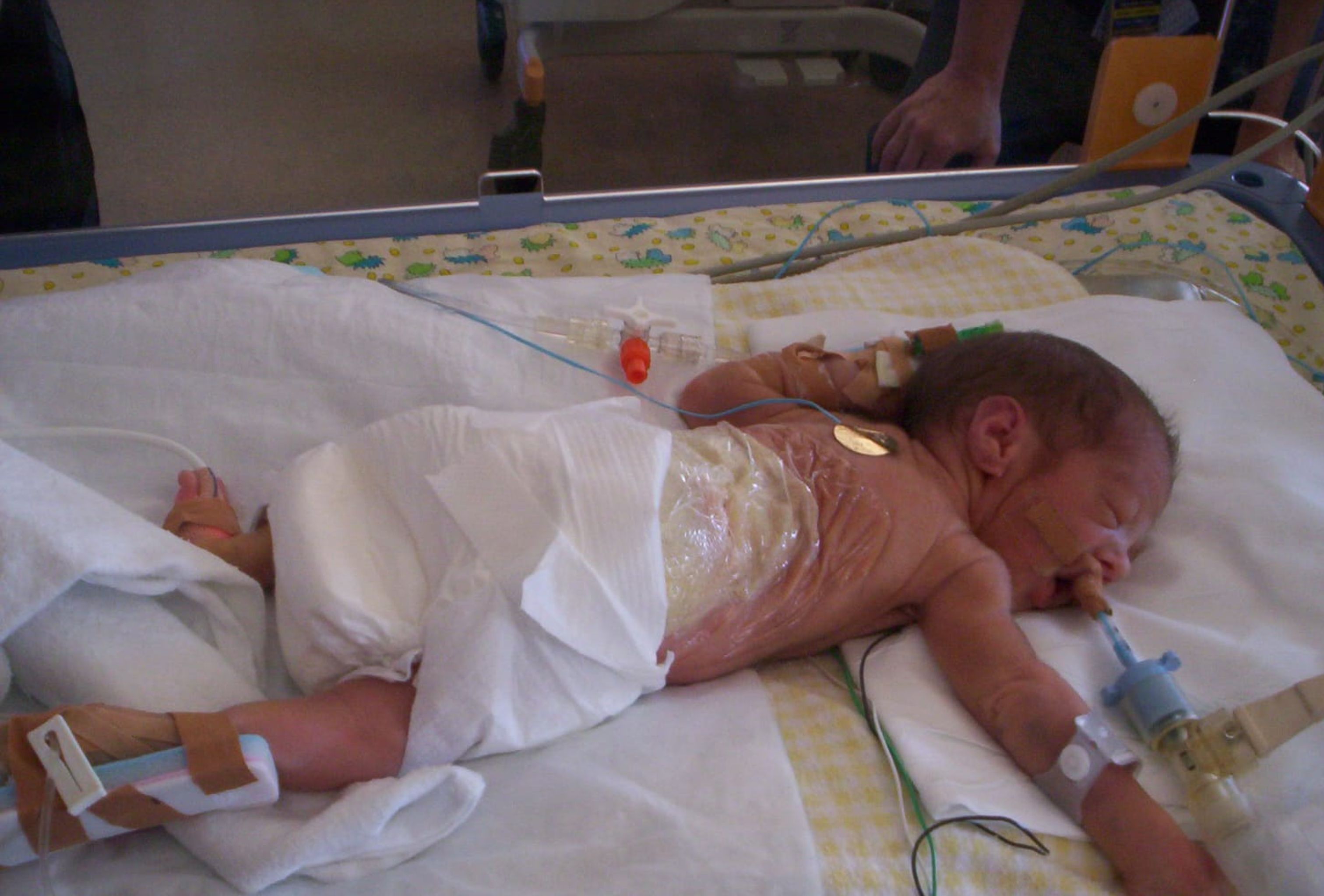 Wyatt as baby in hospital