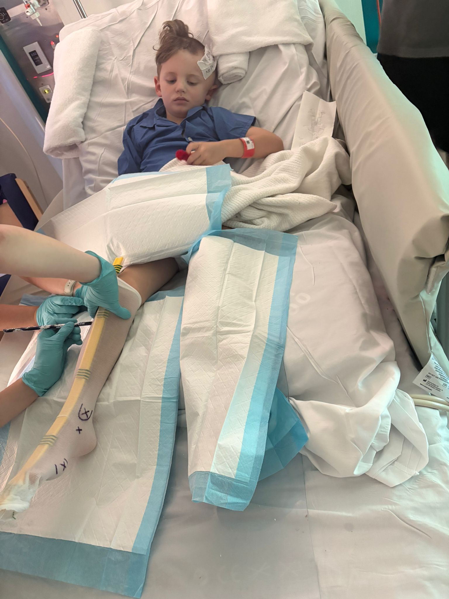 Beau in treatment