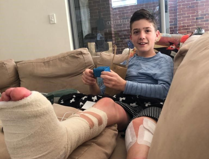 Robbie leg bandages 720 x 550
