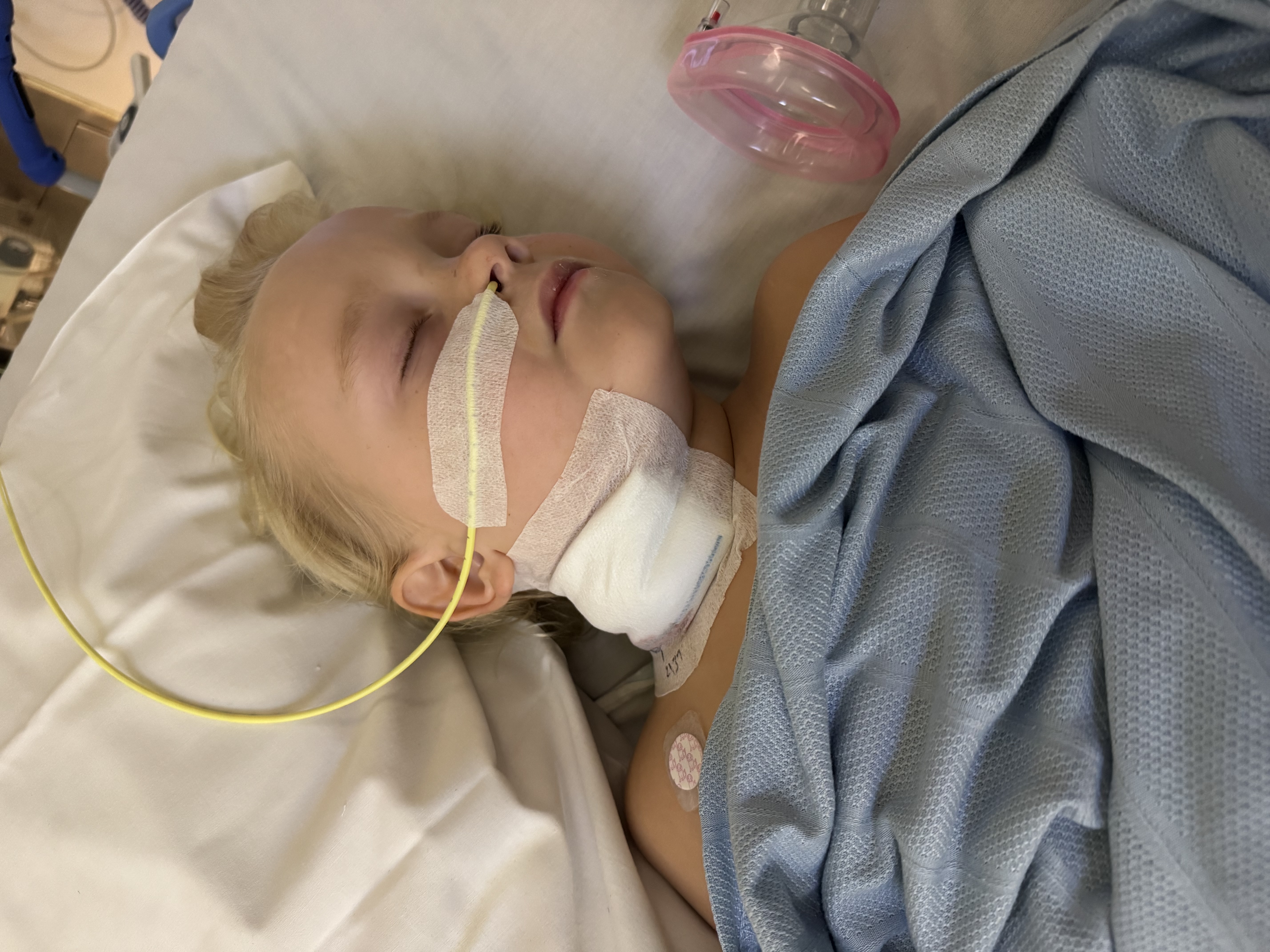 Rocco - feeding tube