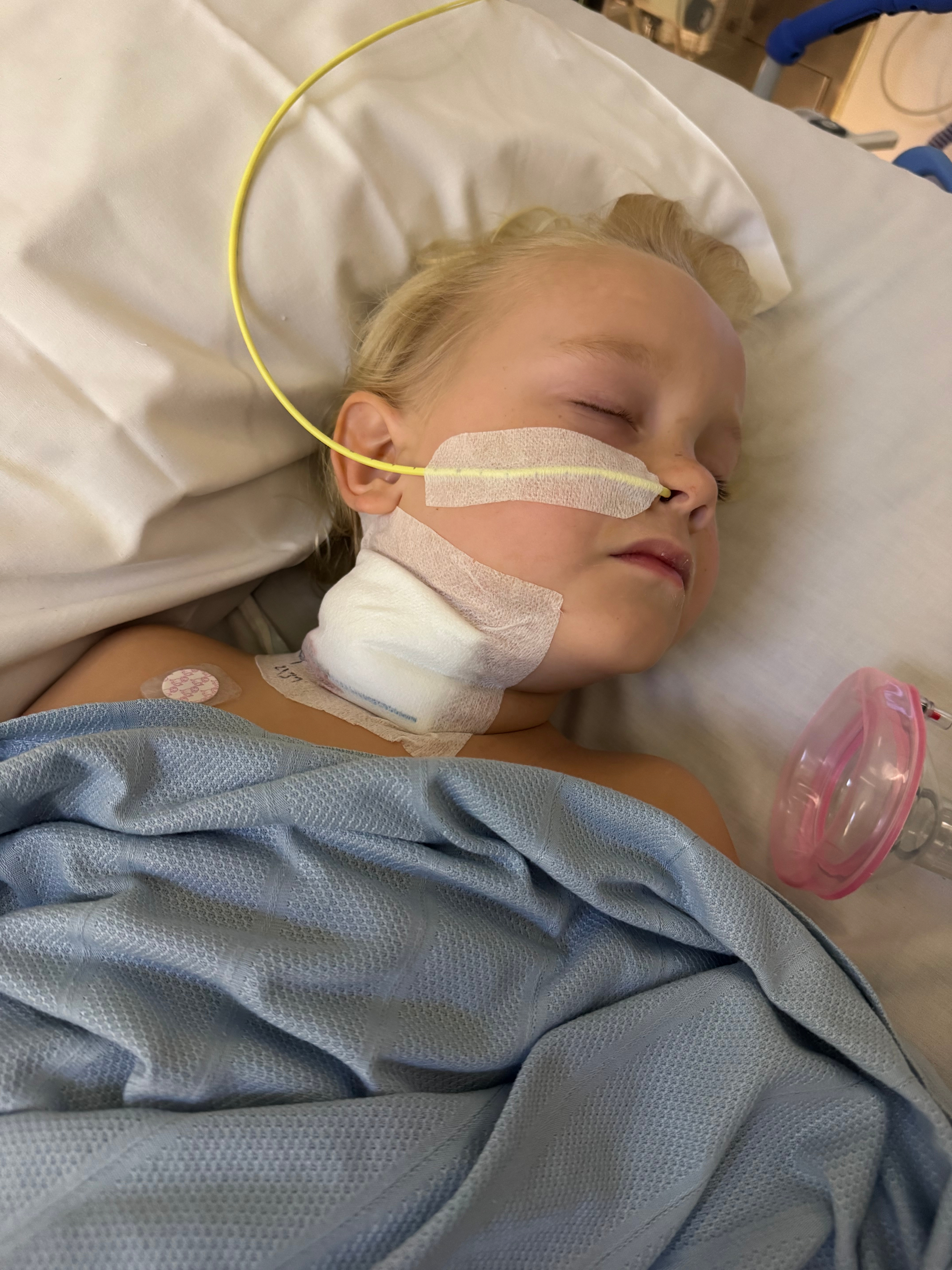 Rocco - feeding tube