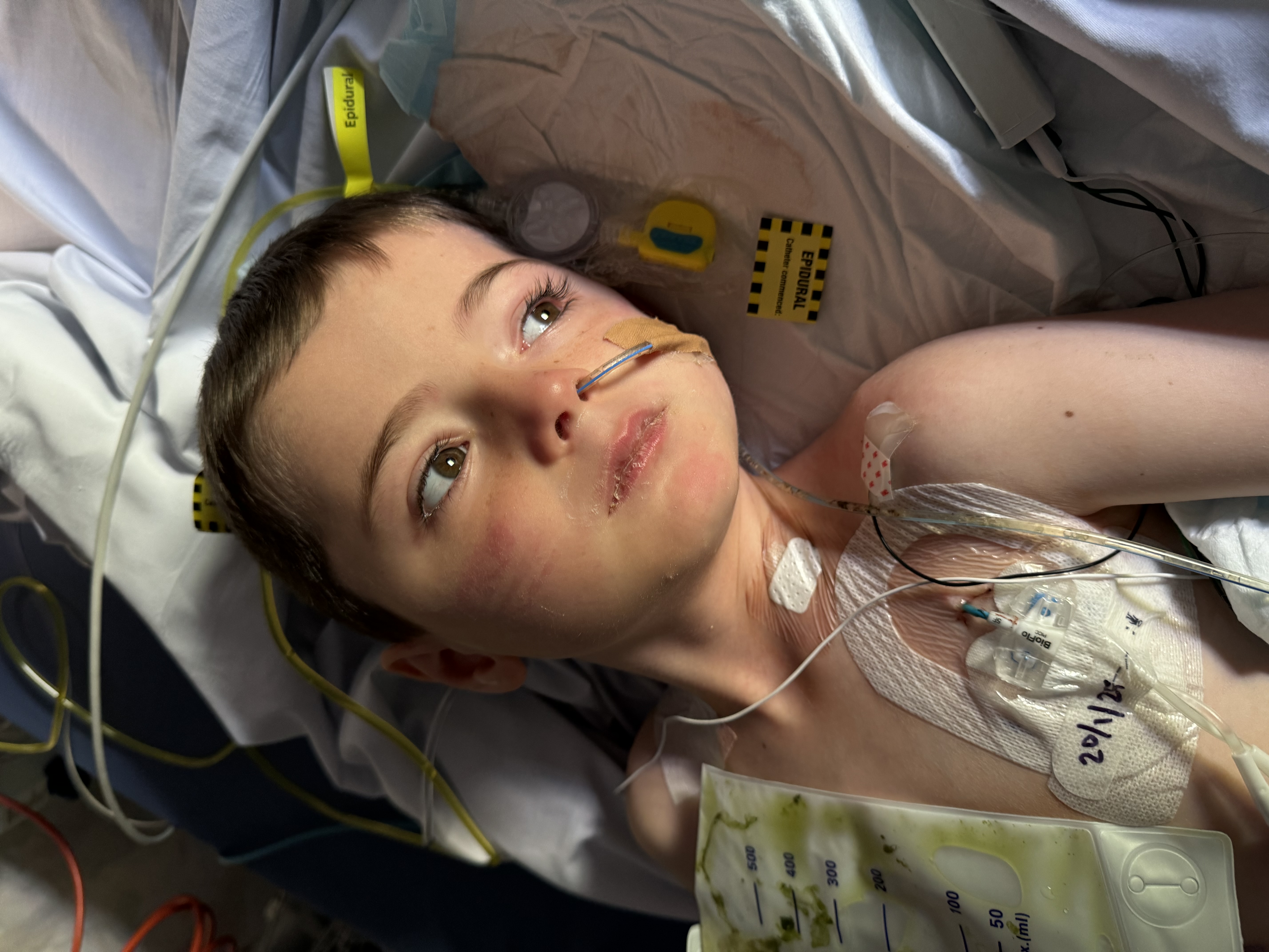 Boston in hospital