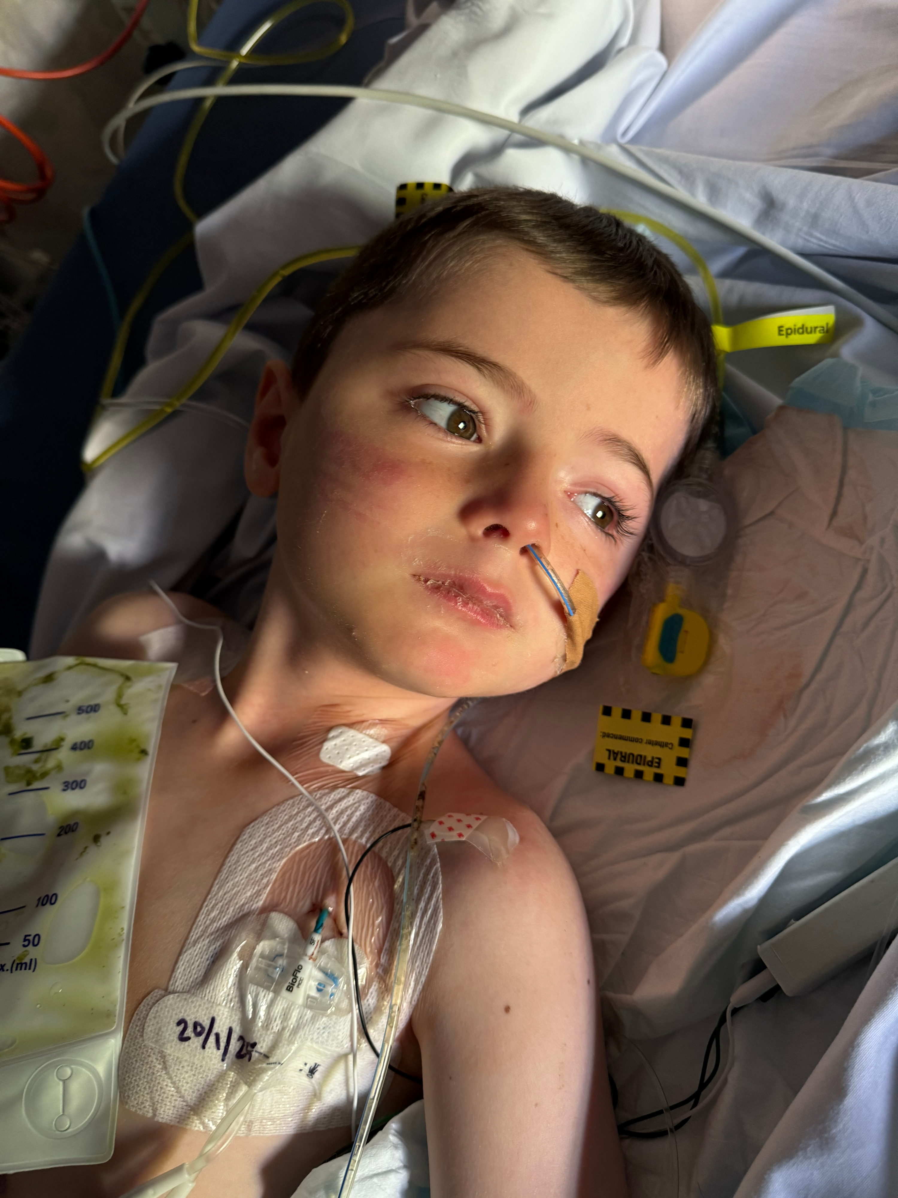 Boston in hospital
