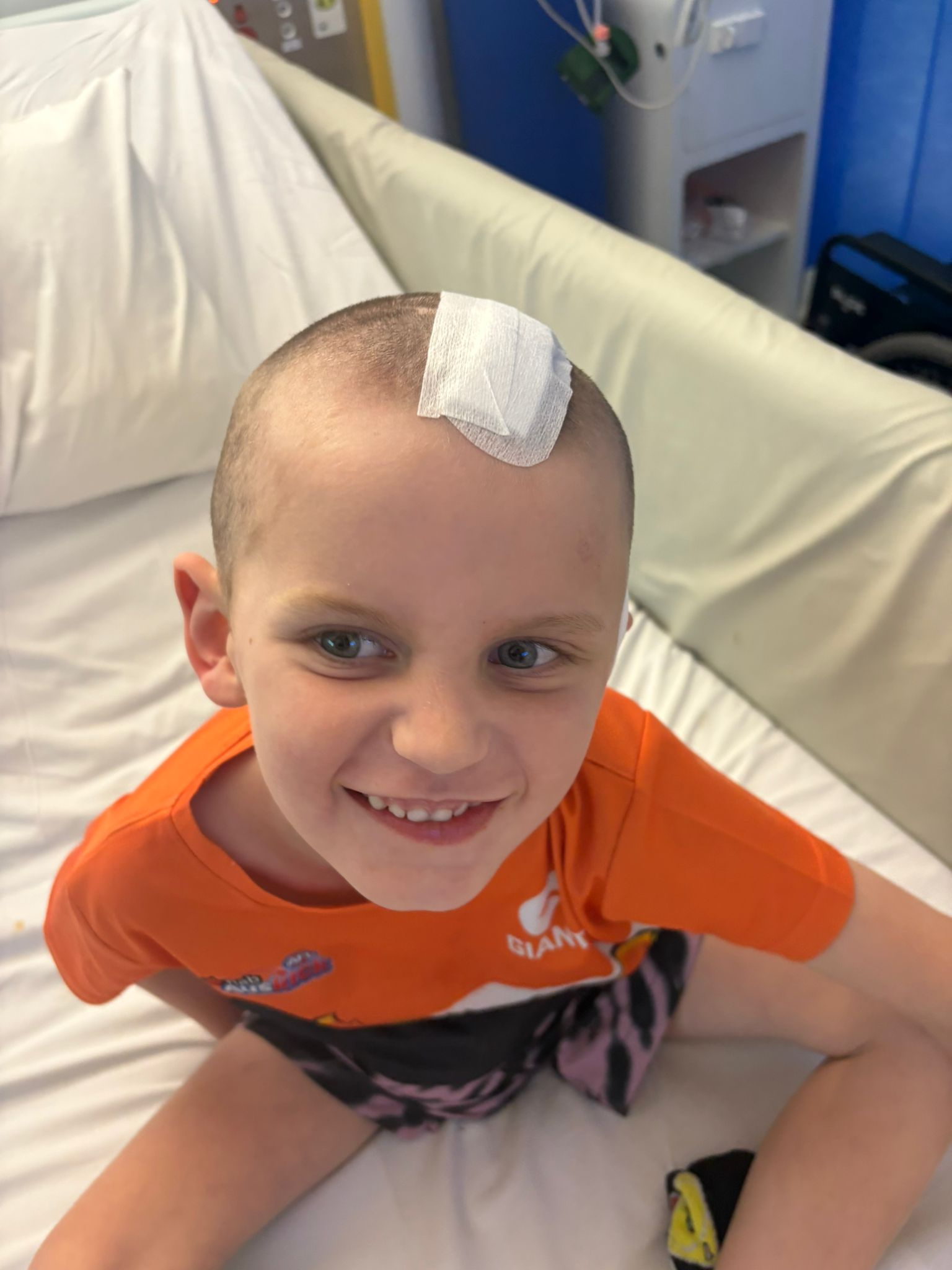 Beau after treatment