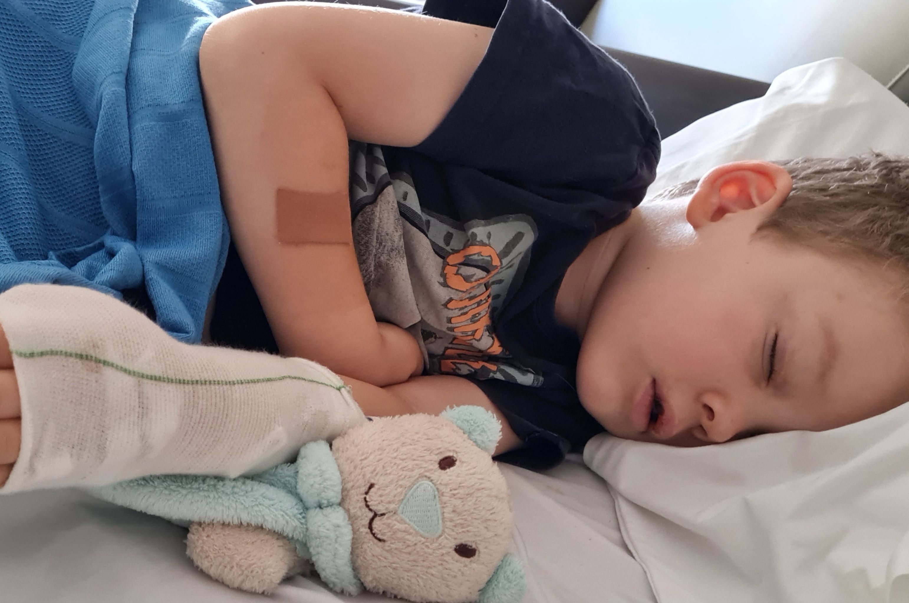 Alex during treatment