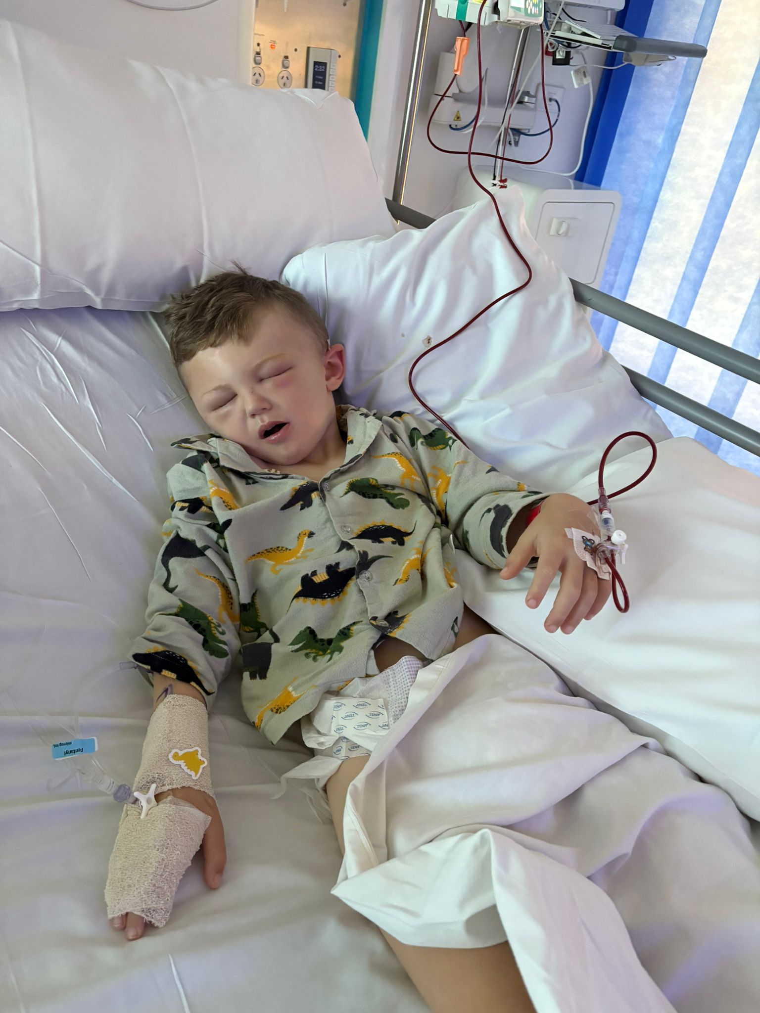 Beau being treated in hospital