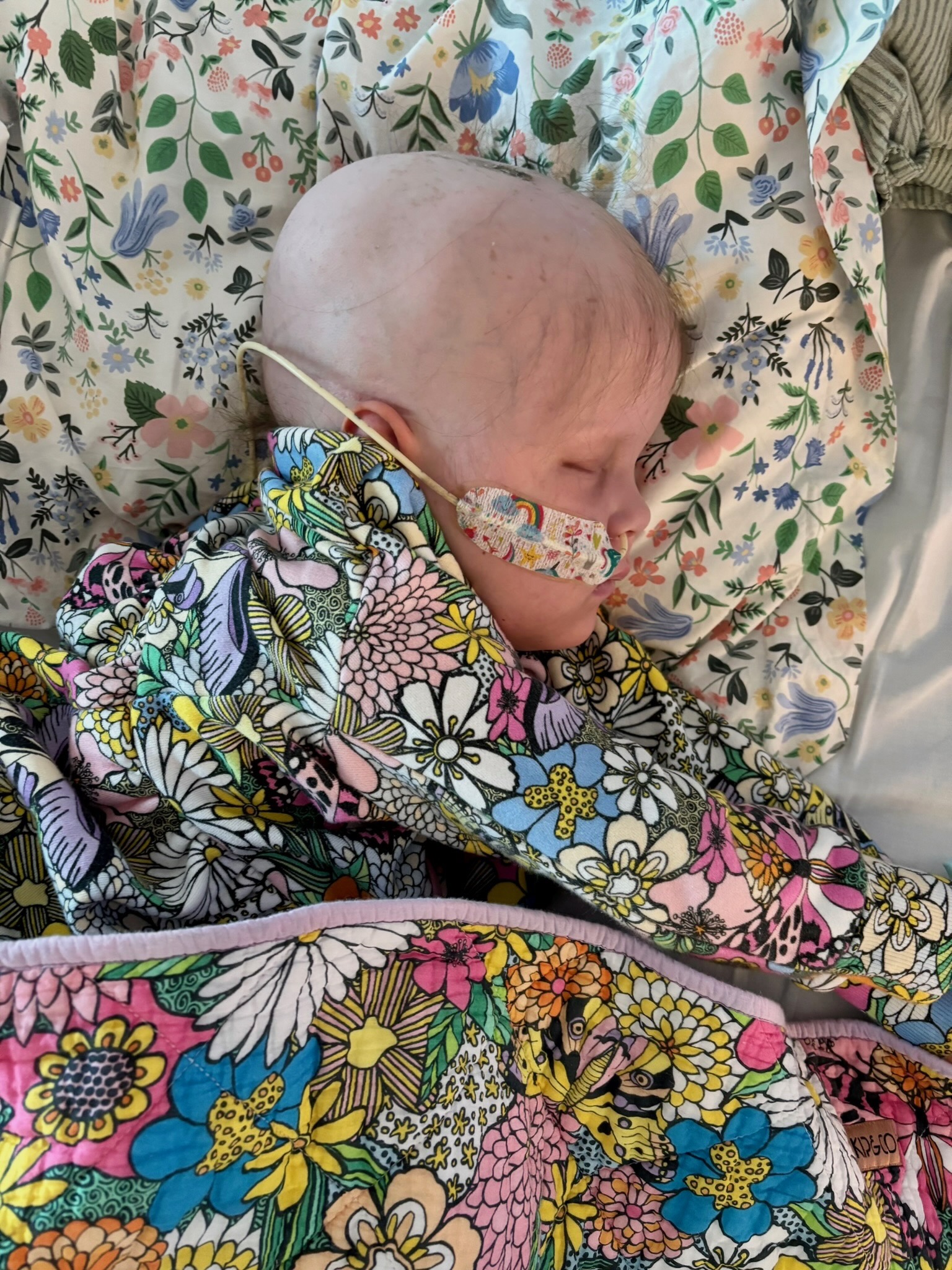 Luna in hospital