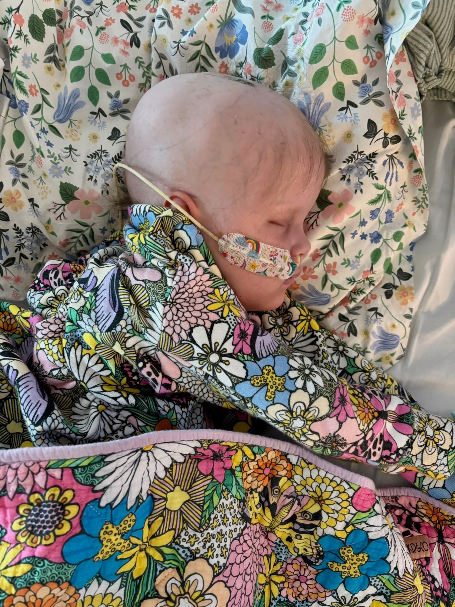 Luna in hospital