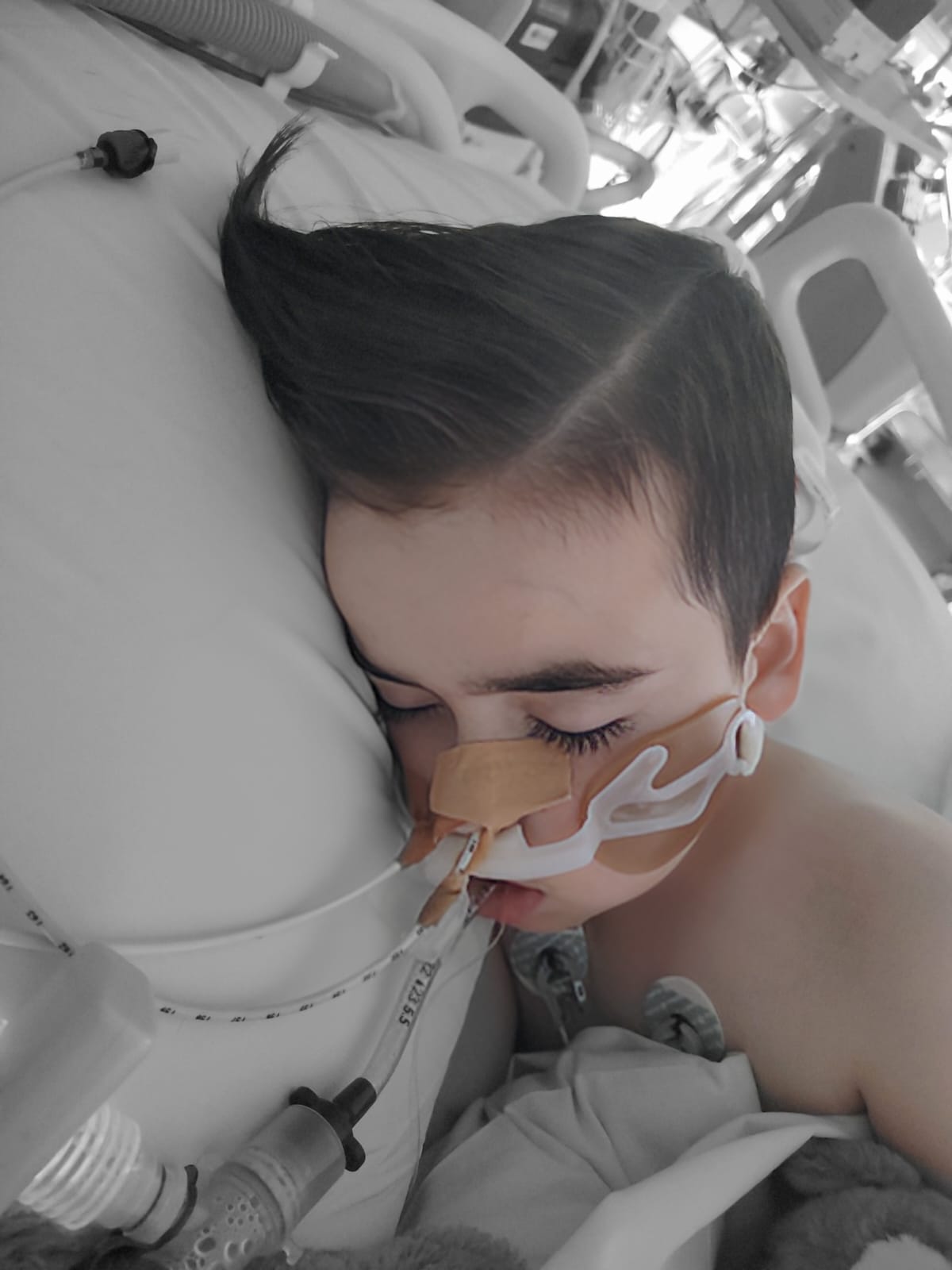 Leo with tubes