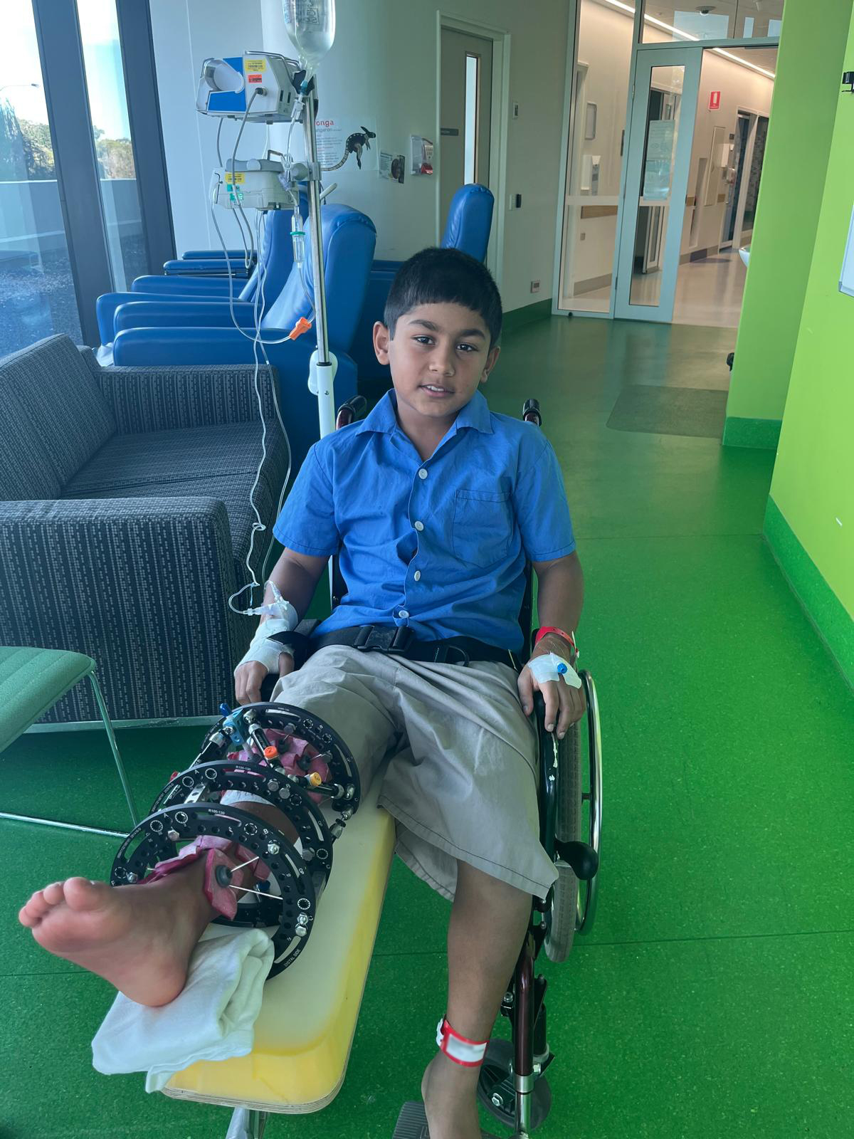 Ryan with broken leg