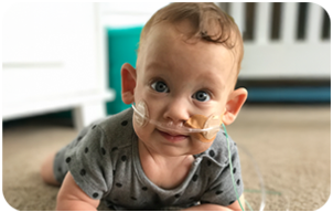 George as a baby on his tummy with nasal tubes