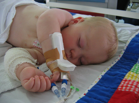 Robbie surgery aged 1 472 x 350