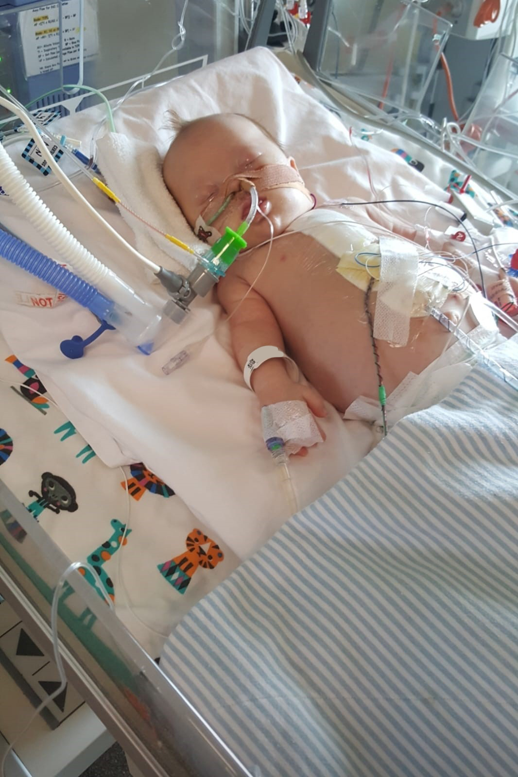 Oliver baby in hospital asleep