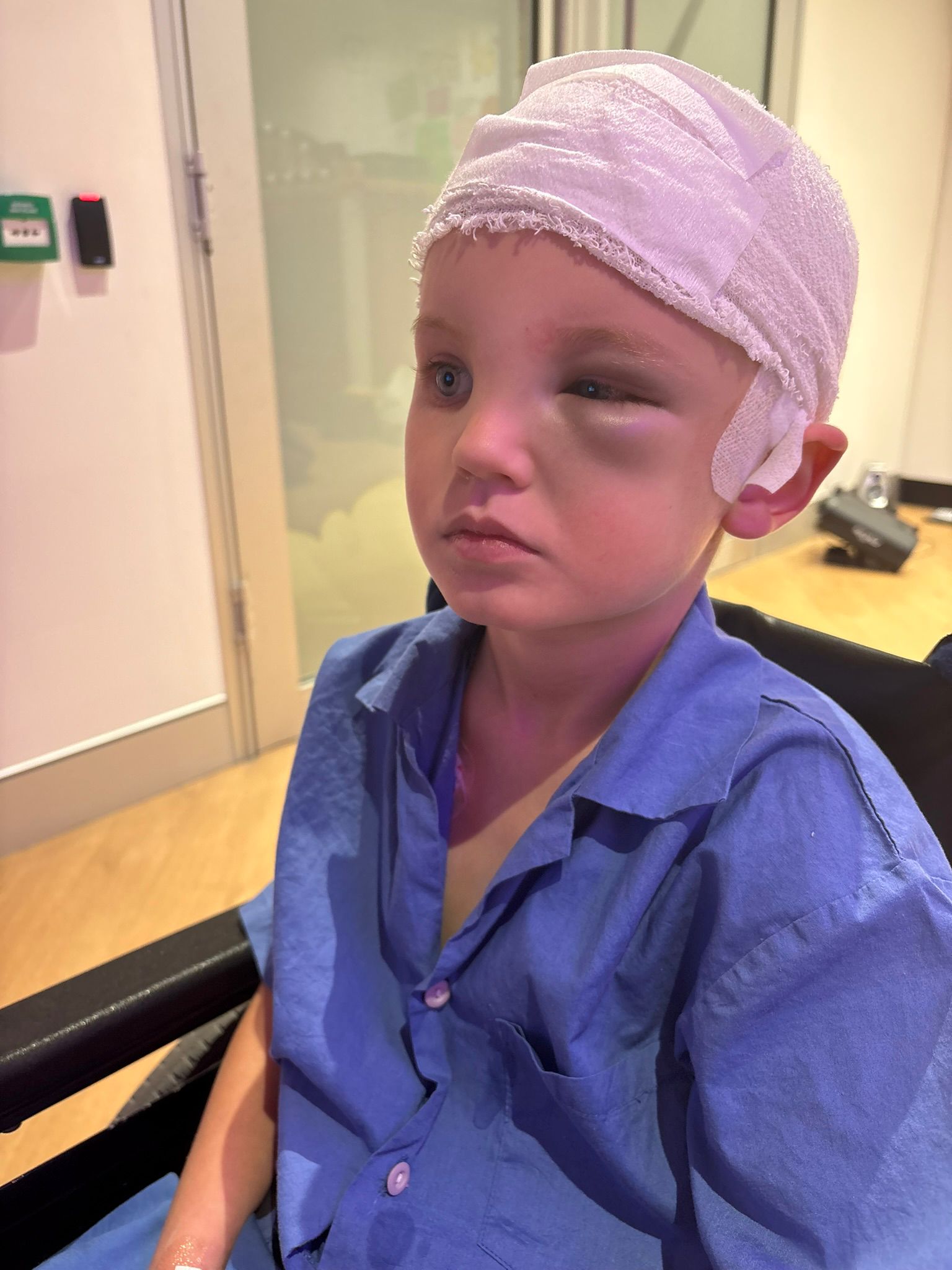 Beau after surgery