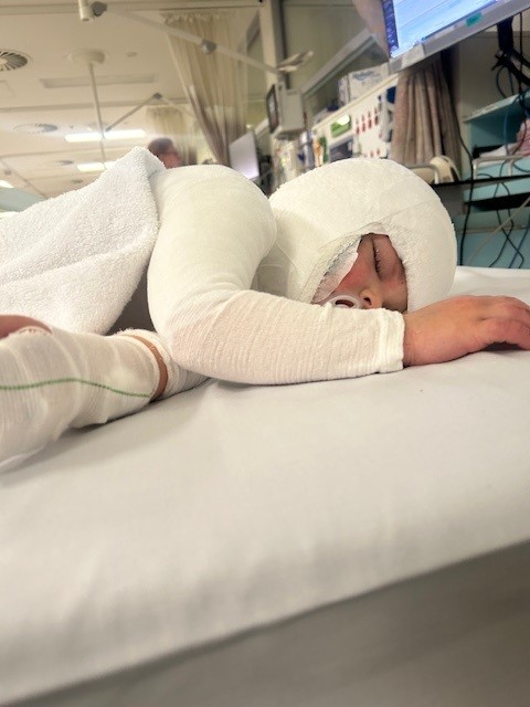 Leo in hospital bed
