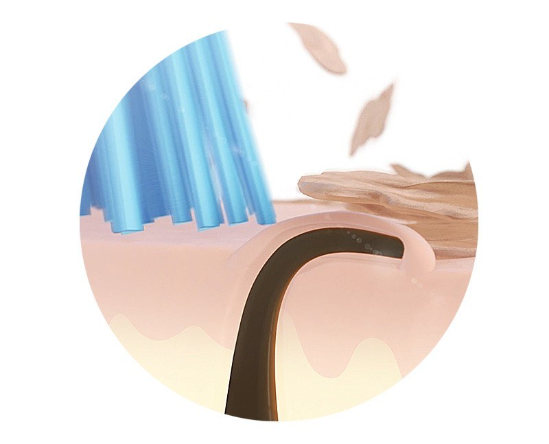 アンダーヘアーを取り除き 埋没毛を避ける方法は ブラウン