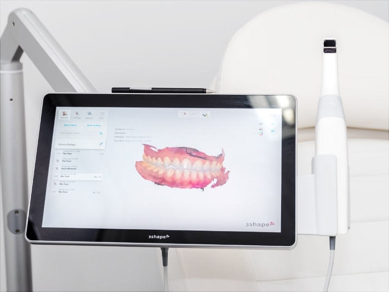 Stilllife-Medical-3D-Scan-Teeth-Preview_12-reasons-why_1_800x560_all_27__