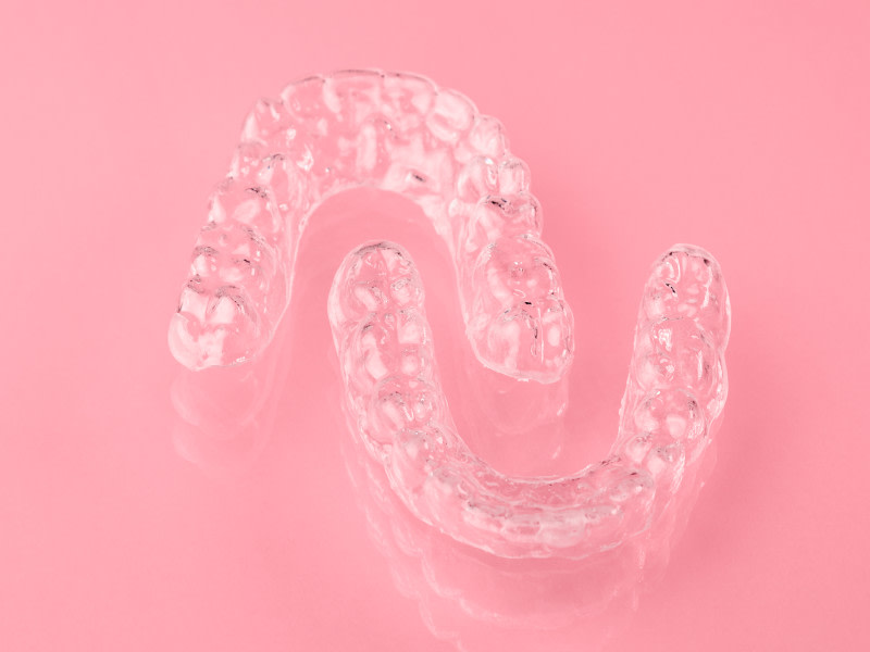 Foto retenedores dentales