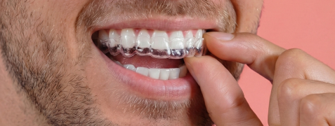 [CRO] Aligner Impress HowItWorks 2.1