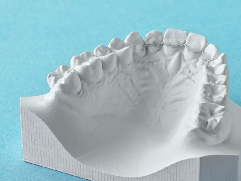 DR SMILE Fixed Retainer Zahnmodell 