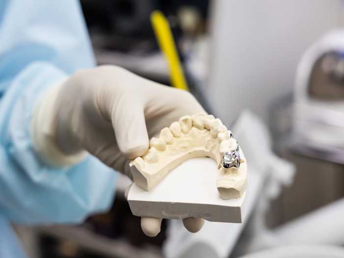 Stilllife-Medical-crown-krone_seo-blog_v1_800x600_all_12__