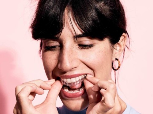 Â¿QuÃ© hay detrÃ¡s de la ortodoncia invisible, este innovador mÃ©todo para alinear los dientes del que todo el mundo habla?