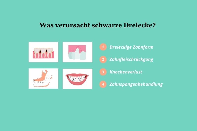Ursachen für schwarze Dreiecke
