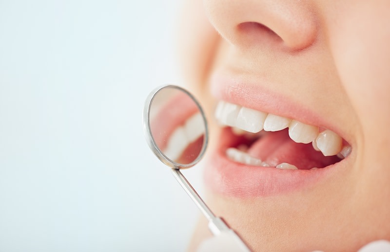 Esaminare i denti con specchietto ortodontico