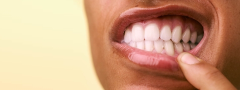 [CRO] Smile - Closed Teeth - Male - Yellow - Background