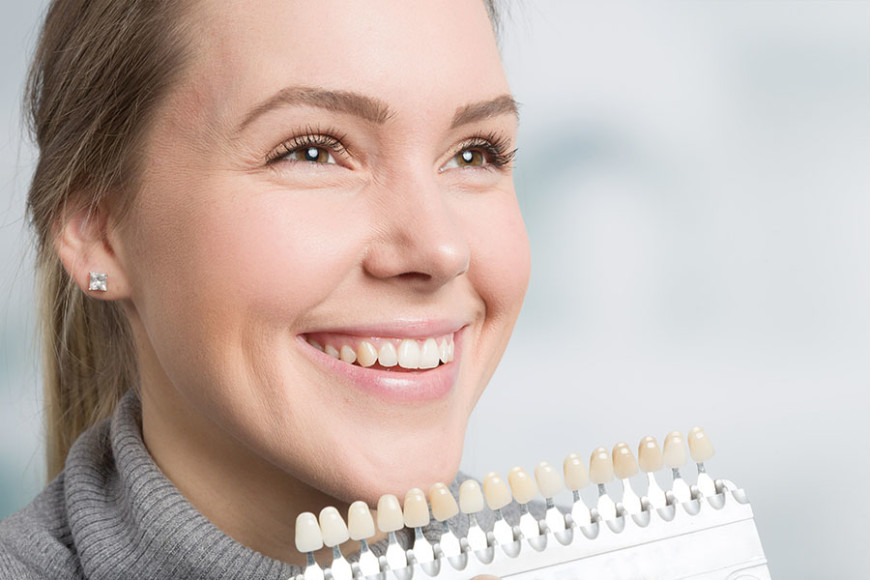 mujer sonriente despues de limpieza dental profesional