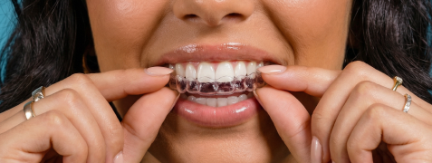 [CRO] During the treatment Impress HowItWorks Dont's 2